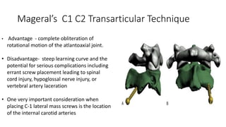Mageral’s C1 C2 Transarticular Technique
• Advantage - complete obliteration of
rotational motion of the atlantoaxial joint.
• Disadvantage- steep learning curve and the
potential for serious complications including
errant screw placement leading to spinal
cord injury, hypoglossal nerve injury, or
vertebral artery laceration
• One very important consideration when
placing C-1 lateral mass screws is the location
of the internal carotid arteries
 