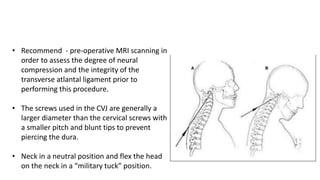 • Recommend - pre-operative MRI scanning in
order to assess the degree of neural
compression and the integrity of the
transverse atlantal ligament prior to
performing this procedure.
• The screws used in the CVJ are generally a
larger diameter than the cervical screws with
a smaller pitch and blunt tips to prevent
piercing the dura.
• Neck in a neutral position and flex the head
on the neck in a “military tuck” position.
 