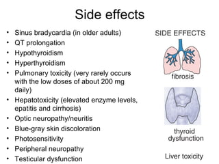 Side effects
• Sinus bradycardia (in older adults)
• QT prolongation
• Hypothyroidism
• Hyperthyroidism
• Pulmonary toxicity (very rarely occurs
with the low doses of about 200 mg
daily)
• Hepatotoxicity (elevated enzyme levels,
epatitis and cirrhosis)
• Optic neuropathy/neuritis
• Blue-gray skin discoloration
• Photosensitivity
• Peripheral neuropathy
• Testicular dysfunction
 