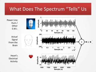 What Does The Spectrum “Tells” Us
                                  2

Power Line




                     Amplitude
   Hum /                          0
    Other
    E.M.I.                       -2
                                      0   20     40      60         80    100    120
                                                      Sample (n)
                            200
    Actual    Amplitude
    Signal                        0
 From the                                                                                   +   xn
     Brain                  -200
                                      0   0.5     1          1.5      2    2.5      3
                                                      Sample (n)                 x 10
                                                                                        4




   Heart’s
                Amplitude




                                 10
 Electrical
   Activity                       0

                            -10
                                 7000     7500        8000         8500   9000
                                                      Sample (n)
 