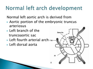 Normal left aortic arch is derived from
 Aortic portion of the embryonic truncus
arteriosus
 Left branch of the
truncoaortic sac
 Left fourth arterial arch
 Left dorsal aorta
 
