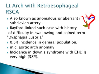  Also known as anomalous or aberrant right
subclavian artery .
 Bayford linked such case with history
of difficulty in swallowing and coined term
“Dysphagia Lusoria”
 0.5% incidence in general population.
 m.c. aortic arch anomaly
 Incidence in down’s syndrome with CHD Is
very high (38%).
 