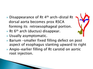  Disappearance of Rt 4th arch-distal Rt
dorsal aorta becomes prox RSCA
forming its retroesophageal portion.
 Rt 6th arch (ductus) disappear.
 Usually asymptomatic.
 Barium –smaller fixed filling defect on post
aspect of esophagus slanting upward to right
 Angio-earlier filling of Rt carotid on aortic
root injection.
 