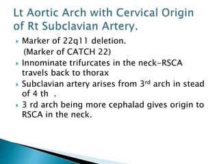  Marker of 22q11 deletion.
(Marker of CATCH 22)
 Innominate trifurcates in the neck-RSCA
travels back to thorax
 Subclavian artery arises from 3rd arch in stead
of 4 th .
 3 rd arch being more cephalad gives origin to
RSCA in the neck.
 