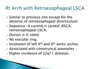  Similar to previous one except for the
absence of retroesophageal diverticulum.
 Sequence –lt carotid,rt carotid ,RSCA,
retroesophageal LSCA.
 Ductus is rt sided.
 No vascular ring.
 Involution of left 4th and 6th aortic arches.
 Associated with conotruncal anomalies .
 Higher incidence of 22q11 deletion.
 