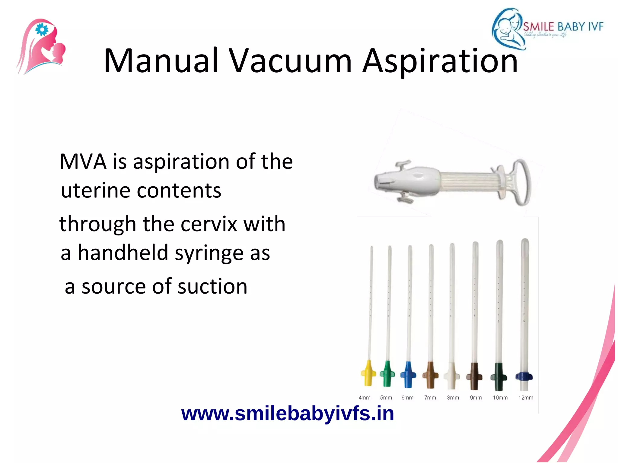 MVA in the management of first trimester abortions | ODP