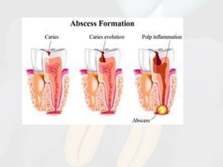 rationale of endodontics | PPTX
