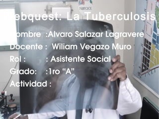 Webquest: La Tuberculosis
 Nombre  :Alvaro Salazar Lagravere
 Docente :  Wiliam Vegazo Muro  
 Rol :         : Asistente Social
 Grado:    :1ro “A”
 Actividad :
 