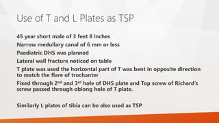 Use of T and L Plates as TSP
45 year short male of 3 feet 8 inches
Narrow medullary canal of 6 mm or less
Paediatric DHS was planned
Lateral wall fracture noticed on table
T plate was used the horizontal part of T was bent in opposite direction
to match the flare of trochanter
Fixed through 2nd and 3rd hole of DHS plate and Top screw of Richard’s
screw passed through oblong hole of T plate.
Similarly L plates of tibia can be also used as TSP
 