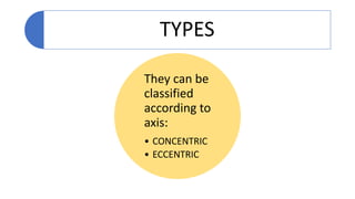 TYPES
They can be
classified
according to
axis:
• CONCENTRIC
• ECCENTRIC
 