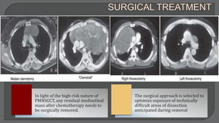 In light of the high-risk nature of
PMNSGCT, any residual mediastinal
mass after chemotherapy needs to
be surgically removed.
The surgical approach is selected to
optimize exposure of technically
difficult areas of dissection
anticipated during removal
 