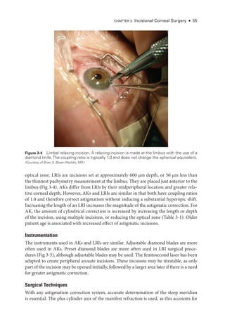 Aao bcsc 2020-2021 13.refractive surgey | PDF