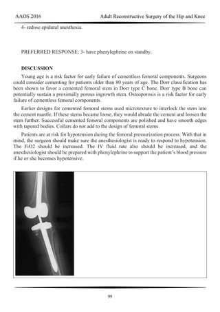 AAOS 2016 Adult Reconstructive Surgery of the Hip and Knee
99
4- redose epidural anesthesia.
PREFERRED RESPONSE: 3- have phenylephrine on standby.
DISCUSSION
Young age is a risk factor for early failure of cementless femoral components. Surgeons
could consider cementing for patients older than 80 years of age. The Dorr classification has
been shown to favor a cemented femoral stem in Dorr type C bone. Dorr type B bone can
potentially sustain a proximally porous ingrowth stem. Osteoporosis is a risk factor for early
failure of cementless femoral components.
Earlier designs for cemented femoral stems used microtexture to interlock the stem into
the cement mantle. If these stems became loose, they would abrade the cement and loosen the
stem further. Successful cemented femoral components are polished and have smooth edges
with tapered bodies. Collars do not add to the design of femoral stems.
Patients are at risk for hypotension during the femoral pressurization process. With that in
mind, the surgeon should make sure the anesthesiologist is ready to respond to hypotension.
The FiO2 should be increased. The IV fluid rate also should be increased, and the
anesthesiologist should be prepared with phenylephrine to support the patient’s blood pressure
if he or she becomes hypotensive.
 