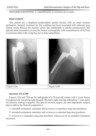 AAOS 2016 Adult Reconstructive Surgery of the Hip and Knee
101
PREFERRED RESPONSE: 2- immobilization in extension for 6 weeks.
DISCUSSION
This patient has a displaced periprosthetic patella fracture with an intact extensor
mechanism. Surgical treatment for this condition has been associated with relatively poor
clinical results because the fracture occurs late (attributable to patella osteonecrosis). The
optimal initial treatment is to treat the fracture nonsurgically with immobilization of the knee
in extension either with a long-leg cast or knee immobilizer.
Figure 122a Figure 122b
Question 122 of 200
Figures 122a and 122b are the radiographs of a 79-year-old woman with a 2-year history
of progressively worsening right hip pain. She had a right total hip arthroplasty 7 years prior.
An infection workup is negative. She opts for revision surgery; the most appropriate surgical
plan to address her femoral component is
1- extended trochanteric osteotomy and revision to a cementless long-stem prosthesis.
2- extended trochanteric osteotomy and revision to a cemented long-stem prosthesis.
3- revision to a cementless long-stem prosthesis without use of an extended trochanteric
osteotomy.
 