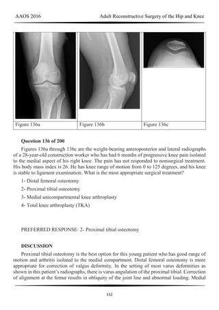 AAOS 2016 Adult Reconstructive Surgery of the Hip and Knee
112
Figure 136a Figure 136b Figure 136c
Question 136 of 200
Figures 136a through 136c are the weight-bearing anteroposterior and lateral radiographs
of a 28-year-old construction worker who has had 6 months of progressive knee pain isolated
to the medial aspect of his right knee. The pain has not responded to nonsurgical treatment.
His body mass index is 26. He has knee range of motion from 0 to 125 degrees, and his knee
is stable to ligament examination. What is the most appropriate surgical treatment?
1- Distal femoral osteotomy
2- Proximal tibial osteotomy
3- Medial unicompartmental knee arthroplasty
4- Total knee arthroplasty (TKA)
PREFERRED RESPONSE: 2- Proximal tibial osteotomy
DISCUSSION
Proximal tibial osteotomy is the best option for this young patient who has good range of
motion and arthritis isolated to the medial compartment. Distal femoral osteotomy is more
appropriate for correction of valgus deformity. In the setting of most varus deformities as
shown in this patient’s radiographs, there is varus angulation of the proximal tibial. Correction
of alignment at the femur results in obliquity of the joint line and abnormal loading. Medial
 