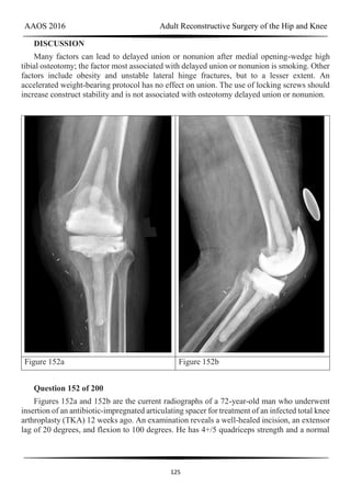 AAOS 2016 Adult Reconstructive Surgery of the Hip and Knee
125
DISCUSSION
Many factors can lead to delayed union or nonunion after medial opening-wedge high
tibial osteotomy; the factor most associated with delayed union or nonunion is smoking. Other
factors include obesity and unstable lateral hinge fractures, but to a lesser extent. An
accelerated weight-bearing protocol has no effect on union. The use of locking screws should
increase construct stability and is not associated with osteotomy delayed union or nonunion.
Figure 152a Figure 152b
Question 152 of 200
Figures 152a and 152b are the current radiographs of a 72-year-old man who underwent
insertion of an antibiotic-impregnated articulating spacer for treatment of an infected total knee
arthroplasty (TKA) 12 weeks ago. An examination reveals a well-healed incision, an extensor
lag of 20 degrees, and flexion to 100 degrees. He has 4+/5 quadriceps strength and a normal
 