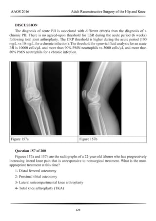 AAOS 2016 Adult Reconstructive Surgery of the Hip and Knee
129
DISCUSSION
The diagnosis of acute PJI is associated with different criteria than the diagnosis of a
chronic PJI. There is no agreed-upon threshold for ESR during the acute period (6 weeks)
following total joint arthroplasty. The CRP threshold is higher during the acute period (100
mg/L vs 10 mg/L for a chronic infection). The threshold for synovial fluid analysis for an acute
PJI is 10000 cells/µL and more than 90% PMN neutrophils vs 3000 cells/µL and more than
80% PMN neutrophils for a chronic infection.
Figure 157a Figure 157b
Question 157 of 200
Figures 157a and 157b are the radiographs of a 22-year-old laborer who has progressively
increasing lateral knee pain that is unresponsive to nonsurgical treatment. What is the most
appropriate treatment at this time?
1- Distal femoral osteotomy
2- Proximal tibial osteotomy
3- Lateral unicompartmental knee arthroplasty
4- Total knee arthroplasty (TKA)
 