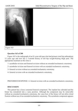 AAOS 2016 Adult Reconstructive Surgery of the Hip and Knee
133
Figure 163
Question 163 of 200
Figure 163 is the radiograph of an 81-year-old man who had primary total hip arthroplasty
12 years ago and now has a 3-month history of left hip weight-bearing thigh pain. The
appropriate treatment at this time is
1- acetabular revision and femoral revision without an extended trochanteric osteotomy.
2- acetabular revision and femoral revision with an extended trochanteric osteotomy.
3- femoral revision without an extended trochanteric osteotomy.
4- femoral revision with an extended trochanteric osteotomy.
PREFERRED RESPONSE: 4- femoral revision with an extended trochanteric osteotomy.
DISCUSSION
This patient has a loose cemented femoral component. The implant has subsided and the
femur has remodeled into a varus position. Although the component may be removable
without an extended trochanteric osteotomy, the varus bow of the femur will not allow distal
fixation without use of an extended trochanteric osteotomy. The acetabular component appears
 