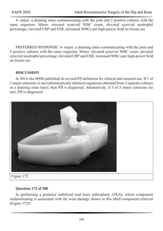 AAOS 2016 Adult Reconstructive Surgery of the Hip and Knee
139
4- major: a draining sinus communicating with the joint and 2 positive cultures with the
same organism. Minor: elevated synovial WBC count, elevated synovial neutrophil
percentage, elevated CRP and ESR, increased WBCs per high-power field on frozen sec
PREFERRED RESPONSE: 4- major: a draining sinus communicating with the joint and
2 positive cultures with the same organism. Minor: elevated synovial WBC count, elevated
synovial neutrophil percentage, elevated CRP and ESR, increased WBCs per high-power field
on frozen sec
DISCUSSION
In 2014, the MSIS published its revised PJI definition for clinical and research use. If 1 of
2 major criterions is met (phenotypically identical organisms obtained from 2 separate cultures
or a draining sinus tract), then PJI is diagnosed. Alternatively, if 3 of 5 minor criterions are
met, PJI is diagnosed.
Figure 172
Question 172 of 200
In performing a posterior stabilized total knee arthroplasty (TKA), which component
malpositioning is associated with the wear damage shown in this tibial component retrieval
(Figure 172)?
 