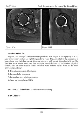 AAOS 2016 Adult Reconstructive Surgery of the Hip and Knee
153
Figure 189c Figure 189d
Question 189 of 200
Figures 189a through 189d are the radiograph and MR images of the right hip of a 28-
year-old woman who has had right hip pain for 3 years. The pain is felt in the groin area, is
exacerbated by weight-bearing activities, and interferes with her activities of daily living. She
has been seen several times and has attempted anti-inflammatory medications, physical
therapy, and an intra-articular steroid injection with minimal relief. What is the most
appropriate next step?
1- Hip arthroscopy and debridement
2- Periacetabular osteotomy
3- Femoral varus-producing osteotomy
4- Total hip arthroplasty (THA)
PREFERRED RESPONSE: 2- Periacetabular osteotomy
DISCUSSION
 