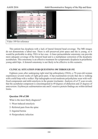 AAOS 2016 Adult Reconstructive Surgery of the Hip and Knee
154
Video 189 for reference
This patient has dysplasia with a lack of lateral femoral head coverage. The MR images
do not demonstrate a labral tear. There is still preserved joint space and she is young, so it
would be preferable to delay THA in her case. A Ganz periacetabular osteotomy can provide
more adequate coverage of the femoral head and is a multiplanar correction of the dysplastic
acetabulum. This osteotomy is an effective treatment for symptomatic dysplasia in prearthritic
young adult hips. A femoral osteotomy is not likely to be effective in this scenario.
CLINICAL SITUATION FOR QUESTIONS 190 THROUGH 192
Eighteen years after undergoing right total hip arthroplasty (THA), a 79-year-old woman
experiences several weeks of right groin pain. A hip examination reveals that she is walking
with a mild limp with a walker. Hip radiographs reveal moderate polyethylene wear with well-
fixed components and mild osteolysis in the greater trochanter. Analysis of a CT scan reveals
that the acetabular component is osteointegrated in 49 degrees of abduction and 25 degrees of
anteversion. Erythrocyte sedimentation rate and C-reactive protein findings are within defined
limits.
Question 190 of 200
What is the most likely diagnosis?
1- Wear-induced osteolysis
2- Referred pain from the spine
3- Inguinal hernia
4- Periprosthetic infection
 