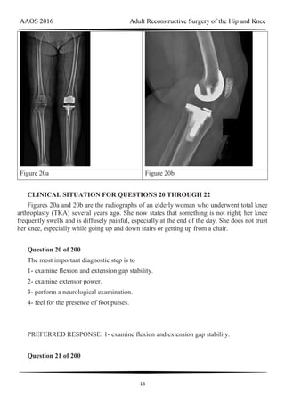 AAOS 2016 Adult Reconstructive Surgery of the Hip and Knee
16
Figure 20a Figure 20b
CLINICAL SITUATION FOR QUESTIONS 20 THROUGH 22
Figures 20a and 20b are the radiographs of an elderly woman who underwent total knee
arthroplasty (TKA) several years ago. She now states that something is not right; her knee
frequently swells and is diffusely painful, especially at the end of the day. She does not trust
her knee, especially while going up and down stairs or getting up from a chair.
Question 20 of 200
The most important diagnostic step is to
1- examine flexion and extension gap stability.
2- examine extensor power.
3- perform a neurological examination.
4- feel for the presence of foot pulses.
PREFERRED RESPONSE: 1- examine flexion and extension gap stability.
Question 21 of 200
 