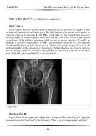 AAOS 2016 Adult Reconstructive Surgery of the Hip and Knee
25
PREFERRED RESPONSE: 3- Antiobiotic susceptibility
DISCUSSION
Knowledge of the basic nomenclature of antibiotic use is important to effectively treat
patients and communicate with colleagues. The effectiveness of an antimicrobial against an
infecting organism is measured by the MIC, which refers to the concentration needed to
prevent growth of a microorganism on culture medium, and MBC, which is the smallest
concentration of the antibiotic necessary to kill the microorganism in culture. Typically, an
antibiotic is considered bactericidal if the MBC is no more than 4 times the MIC. The spectrum
of antimicrobial coverage refers to an agent’s effectiveness against a range of bacteria. An
antibiogram refers to the tabulation of prevalence of different bacteria in a specific setting or
specific patient population. Antibiotic susceptibility and resistance refers to the bacteria’s
ability to be affected or unaffected by a given antibiotic.
Figure 30a
Question 30 of 200
Figure 30a is the anteroposterior radiograph of a 20-year-old woman with mild right groin
pain and intermittent “catching” in the hip region. What is the most appropriate next step?
 