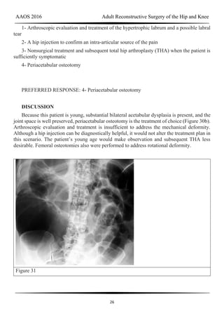 AAOS 2016 Adult Reconstructive Surgery of the Hip and Knee
26
1- Arthroscopic evaluation and treatment of the hypertrophic labrum and a possible labral
tear
2- A hip injection to confirm an intra-articular source of the pain
3- Nonsurgical treatment and subsequent total hip arthroplasty (THA) when the patient is
sufficiently symptomatic
4- Periacetabular osteotomy
PREFERRED RESPONSE: 4- Periacetabular osteotomy
DISCUSSION
Because this patient is young, substantial bilateral acetabular dysplasia is present, and the
joint space is well preserved, periacetabular osteotomy is the treatment of choice (Figure 30b).
Arthroscopic evaluation and treatment is insufficient to address the mechanical deformity.
Although a hip injection can be diagnostically helpful, it would not alter the treatment plan in
this scenario. The patient’s young age would make observation and subsequent THA less
desirable. Femoral osteotomies also were performed to address rotational deformity.
Figure 31
 