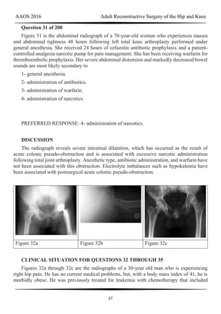 AAOS 2016 Adult Reconstructive Surgery of the Hip and Knee
27
Question 31 of 200
Figure 31 is the abdominal radiograph of a 70-year-old woman who experiences nausea
and abdominal tightness 48 hours following left total knee arthroplasty performed under
general anesthesia. She received 24 hours of cefazolin antibiotic prophylaxis and a patient-
controlled analgesia narcotic pump for pain management. She has been receiving warfarin for
thromboembolic prophylaxis. Her severe abdominal distension and markedly decreased bowel
sounds are most likely secondary to
1- general anesthesia.
2- administration of antibiotics.
3- administration of warfarin.
4- administration of narcotics.
PREFERRED RESPONSE: 4- administration of narcotics.
DISCUSSION
The radiograph reveals severe intestinal dilatation, which has occurred as the result of
acute colonic pseudo-obstruction and is associated with excessive narcotic administration
following total joint arthroplasty. Anesthetic type, antibiotic administration, and warfarin have
not been associated with this obstruction. Electrolyte imbalances such as hypokalemia have
been associated with postsurgical acute colonic pseudo-obstruction.
Figure 32a Figure 32b Figure 32c
CLINICAL SITUATION FOR QUESTIONS 32 THROUGH 35
Figures 32a through 32c are the radiographs of a 30-year old man who is experiencing
right hip pain. He has no current medical problems, but, with a body mass index of 41, he is
morbidly obese. He was previously treated for leukemia with chemotherapy that included
 
