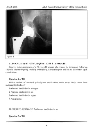 AAOS 2016 Adult Reconstructive Surgery of the Hip and Knee
4
Figure 4
CLINICAL SITUATION FOR QUESTIONS 4 THROUGH 7
Figure 4 is the radiograph of a 73-year-old woman who returns for her annual follow-up
14 years after undergoing total hip arthroplasty. She denies pain and has no discomfort upon
examination.
Question 4 of 200
Which method of terminal polyethylene sterilization would most likely cause these
radiographic findings?
1- Gamma irradiation in nitrogen
2- Gamma irradiation in air
3- Gamma irradiation in argon
4- Gas plasma
PREFERRED RESPONSE: 2- Gamma irradiation in air
Question 5 of 200
 