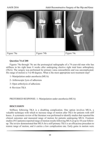 AAOS 2016 Adult Reconstructive Surgery of the Hip and Knee
60
Figure 74a Figure 74b Figure 74c
Question 74 of 200
Figures 74a through 74c are the postsurgical radiographs of a 74-year-old man who has
stiffness in his right knee 8 weeks after undergoing elective right total knee arthroplasty
(TKA). The surgery was performed for primary varus osteoarthritis and was uncomplicated.
His range of motion is 5 to 80 degrees. What is the most appropriate next treatment step?
1- Manipulation under anesthesia (MUA)
2- Arthroscopic lysis of adhesions
3- Open arthrolysis of adhesions
4- Revision TKA
PREFERRED RESPONSE: 1- Manipulation under anesthesia (MUA)
DISCUSSION
Stiffness following TKA is a disabling complication. One option involves MUA, a
valuable technique with which to increase range of motion after TKA for patients with stiff
knees. A systematic review of the literature was performed to identify studies that reported the
clinical outcomes and measured range of motion for patients undergoing MUA. Fourteen
studies (913 patients) reported range of motion results following MUA at up to 10-year follow-
up. The review demonstrated that MUA for a stiff primary TKA is an efficacious procedure to
restore range of motion, and it carries a low complication rate. Early gains in motion were
 