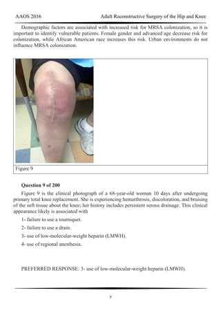 AAOS 2016 Adult Reconstructive Surgery of the Hip and Knee
7
Demographic factors are associated with increased risk for MRSA colonization, so it is
important to identify vulnerable patients. Female gender and advanced age decrease risk for
colonization, while African American race increases this risk. Urban environments do not
influence MRSA colonization.
Figure 9
Question 9 of 200
Figure 9 is the clinical photograph of a 68-year-old woman 10 days after undergoing
primary total knee replacement. She is experiencing hemarthrosis, discoloration, and bruising
of the soft tissue about the knee; her history includes persistent serous drainage. This clinical
appearance likely is associated with
1- failure to use a tourniquet.
2- failure to use a drain.
3- use of low-molecular-weight heparin (LMWH).
4- use of regional anesthesia.
PREFERRED RESPONSE: 3- use of low-molecular-weight heparin (LMWH).
 