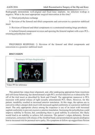 AAOS 2016 Adult Reconstructive Surgery of the Hip and Knee
80
Radiographs demonstrate well-aligned and fixed knee implants. An infection workup is
negative. What is the most appropriate surgical intervention at this time?
1- Tibial polyethylene exchange
2- Revision of the femoral and tibial components and conversion to a posterior stabilized
insert
3- Revision of femoral and tibial components to a constrained rotating hinge prosthesis
4- Isolated femoral component revision and upsizing the femoral implant with a new PCL-
retaining polyethylene insert
PREFERRED RESPONSE: 2- Revision of the femoral and tibial components and
conversion to a posterior stabilized insert
DISCUSSION
Video 99 for reference
This patient has valgus knee alignment, and, after undergoing appropriate bone resections
and soft-tissue balancing, has demonstrated a tight PCL on trial reduction as evidenced by lift-
off of the trial insert as described by Scott and Chmell. The appropriate maneuver is PCL
recession with partial release of tight (usually anterolateral) PCL fibers. However, for this
patient, instability resulted in increased anterior translation. At this stage, the options are to
convert to either a deeper-dish insert with increased sagittal conformity or a posterior stabilized
insert. The only appropriate choice among the responses is use of an insert with increased
sagittal conformity to prevent excessive anterior translation. Increasing the polyethylene could
improve stability in flexion, but, considering there is good stability in extension, this likely
would lead to an inability to achieve full extension. The patient’s valgus deformity, flexion
contracture, correction with release of the iliotibial band, and posterolateral capsule predispose
him to increased risk for peroneal nerve palsy. His symptoms at follow-up suggest knee flexion
 