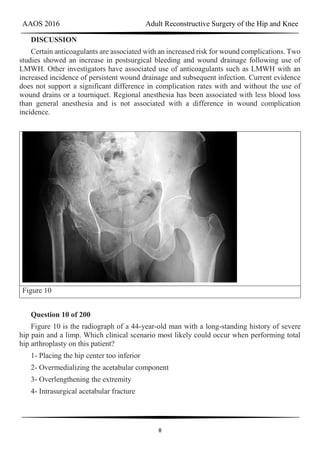 AAOS 2016 Adult Reconstructive Surgery of the Hip and Knee
8
DISCUSSION
Certain anticoagulants are associated with an increased risk for wound complications. Two
studies showed an increase in postsurgical bleeding and wound drainage following use of
LMWH. Other investigators have associated use of anticoagulants such as LMWH with an
increased incidence of persistent wound drainage and subsequent infection. Current evidence
does not support a significant difference in complication rates with and without the use of
wound drains or a tourniquet. Regional anesthesia has been associated with less blood loss
than general anesthesia and is not associated with a difference in wound complication
incidence.
Figure 10
Question 10 of 200
Figure 10 is the radiograph of a 44-year-old man with a long-standing history of severe
hip pain and a limp. Which clinical scenario most likely could occur when performing total
hip arthroplasty on this patient?
1- Placing the hip center too inferior
2- Overmedializing the acetabular component
3- Overlengthening the extremity
4- Intrasurgical acetabular fracture
 