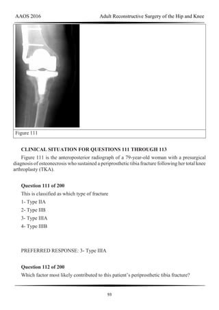 AAOS 2016 Adult Reconstructive Surgery of the Hip and Knee
93
Figure 111
CLINICAL SITUATION FOR QUESTIONS 111 THROUGH 113
Figure 111 is the anteroposterior radiograph of a 79-year-old woman with a presurgical
diagnosis of osteonecrosis who sustained a periprosthetic tibia fracture following her total knee
arthroplasty (TKA).
Question 111 of 200
This is classified as which type of fracture
1- Type IIA
2- Type IIB
3- Type IIIA
4- Type IIIB
PREFERRED RESPONSE: 3- Type IIIA
Question 112 of 200
Which factor most likely contributed to this patient’s periprosthetic tibia fracture?
 