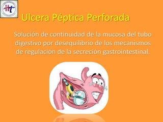 Solución de continuidad de la mucosa del tubo
digestivo por desequilibrio de los mecanismos
de regulación de la secreción gastrointestinal.
Ulcera Péptica Perforada
 