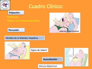 Percusión
Pérdida de la Matidez Hepática
Signo de Jobert
Auscultación:
Silencio Abdominal
Palpación:
•Defensa
•Dolor a la Descompresión
 