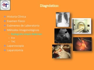 Historia Clínica
Examen Físico
Exámenes de Laboratorio
Métodos Imagenológicos
– Radiografía Simple Abdomen
– Eco
– TAC
Laparoscopia
Laparotomía
 