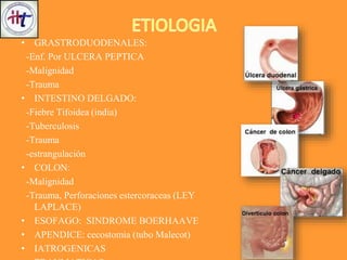 • GRASTRODUODENALES:
-Enf. Por ULCERA PEPTICA
-Malignidad
-Trauma
• INTESTINO DELGADO:
-Fiebre Tifoidea (india)
-Tuberculosis
-Trauma
-estrangulación
• COLON:
-Malignidad
-Trauma, Perforaciones estercoraceas (LEY
LAPLACE)
• ESOFAGO: SINDROME BOERHAAVE
• APENDICE: cecostomia (tubo Malecot)
• IATROGENICAS
 
