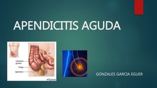 APENDICITIS AGUDA
GONZALES GARCIA EGUER
 