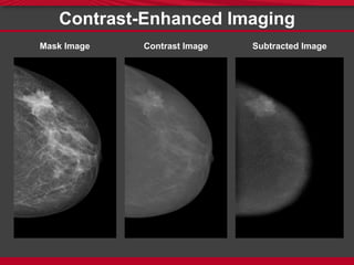Contrast-Enhanced Imaging
Mask Image Contrast Image Subtracted Image
 