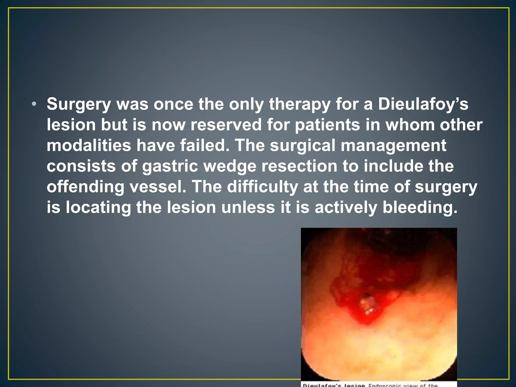 • Surgery was once the only therapy for a Dieulafoy’s
lesion but is now reserved for patients in whom other
modalities have failed. The surgical management
consists of gastric wedge resection to include the
offending vessel. The difficulty at the time of surgery
is locating the lesion unless it is actively bleeding.
 