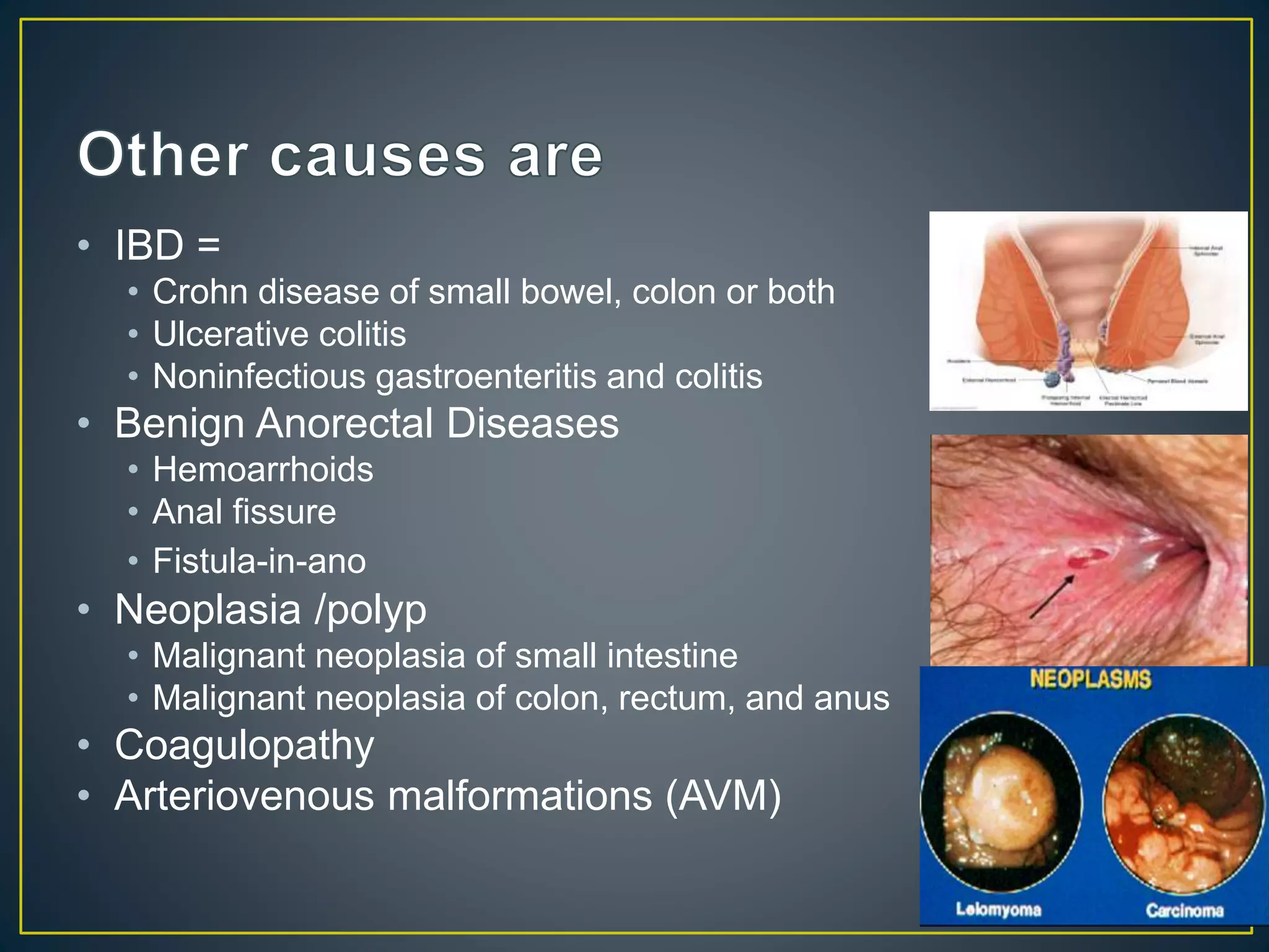 • IBD =
• Crohn disease of small bowel, colon or both
• Ulcerative colitis
• Noninfectious gastroenteritis and colitis
• Benign Anorectal Diseases
• Hemoarrhoids
• Anal fissure
• Fistula-in-ano
• Neoplasia /polyp
• Malignant neoplasia of small intestine
• Malignant neoplasia of colon, rectum, and anus
• Coagulopathy
• Arteriovenous malformations (AVM)
 