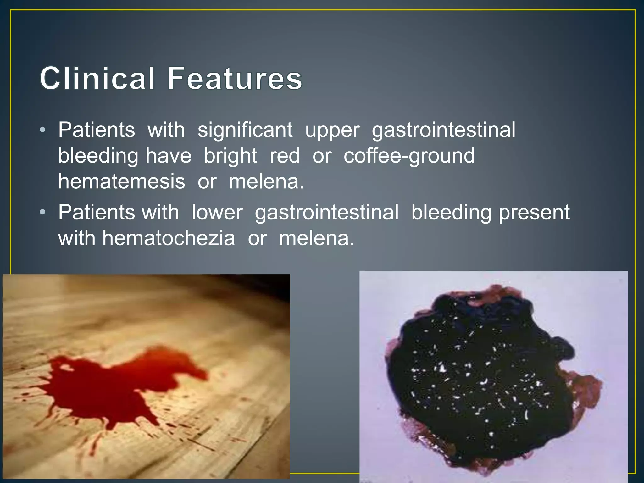 • Patients with significant upper gastrointestinal
bleeding have bright red or coffee-ground
hematemesis or melena.
• Patients with lower gastrointestinal bleeding present
with hematochezia or melena.
 