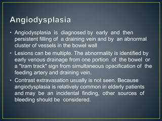 An Approach to Gastrointestinal Bleeding Slide 95