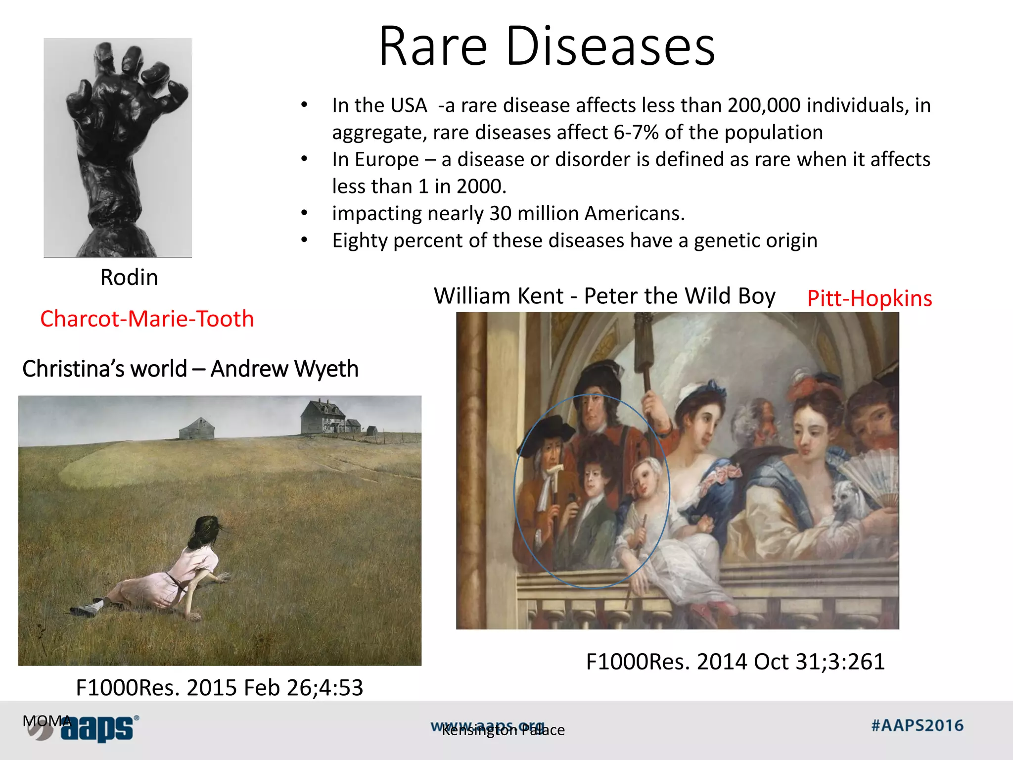 Christina’s world – Andrew Wyeth
MOMA
Rodin
William Kent - Peter the Wild Boy
Rare Diseases
Charcot-Marie-Tooth
Pitt-Hopkins
Kensington Palace
• In the USA -a rare disease affects less than 200,000 individuals, in
aggregate, rare diseases affect 6-7% of the population
• In Europe – a disease or disorder is defined as rare when it affects
less than 1 in 2000.
• impacting nearly 30 million Americans.
• Eighty percent of these diseases have a genetic origin
F1000Res. 2015 Feb 26;4:53
F1000Res. 2014 Oct 31;3:261
 