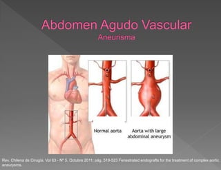 Aorta Normal Aorta aneurism·tica
Rev. Chilena de Cirugía. Vol 63 - Nº 5, Octubre 2011; pág. 519-523 Fenestrated endografts for the treatment of complex aortic
aneurysms.
 