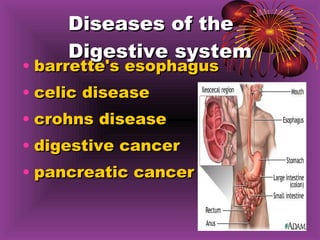 Diseases of the Digestive system barrette's esophagus celic disease crohns disease digestive cancer pancreatic cancer 