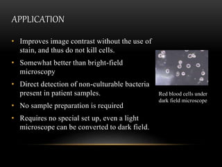 APPLICATION
• Improves image contrast without the use of
stain, and thus do not kill cells.
• Somewhat better than bright-field
microscopy
• Direct detection of non-culturable bacteria
present in patient samples.
• No sample preparation is required
• Requires no special set up, even a light
microscope can be converted to dark field.
Red blood cells under
dark field microscope
 