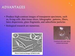 ADVANTAGES
• Produce high-contrast images of transparent specimens, such
as, living cells ,thin tissue slices, lithographic patterns, fibers,
latex dispersions, glass fragments, and subcellular particles
• biological research are numerous.
Unstained cells under phase
contrast microscope
 
